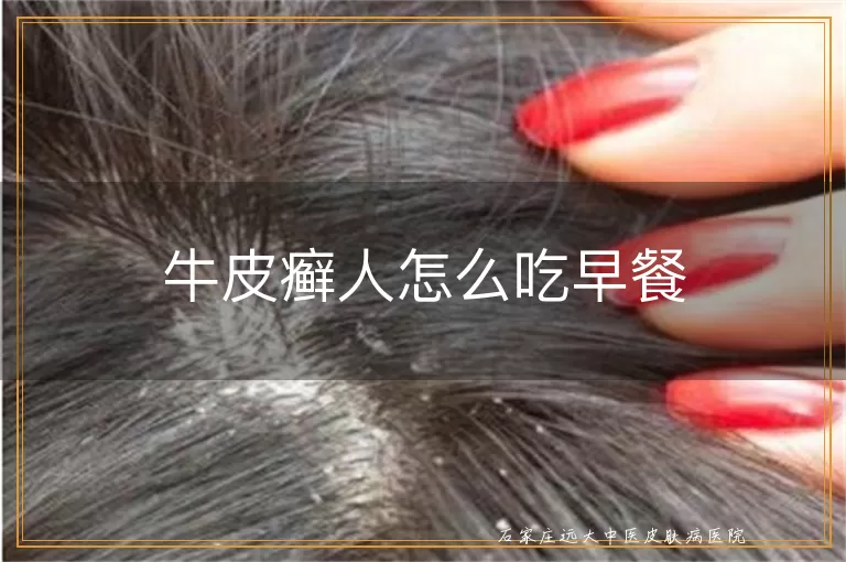 牛皮癣人怎么吃早餐