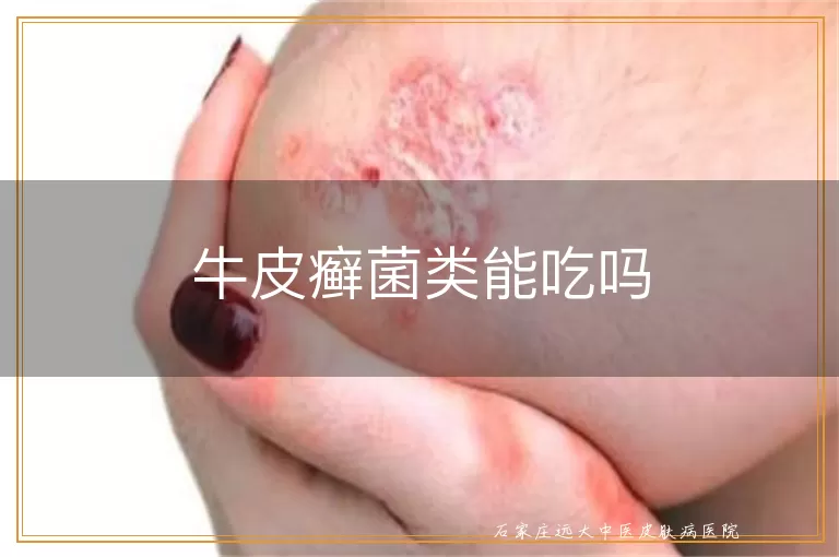 牛皮癣菌类能吃吗
