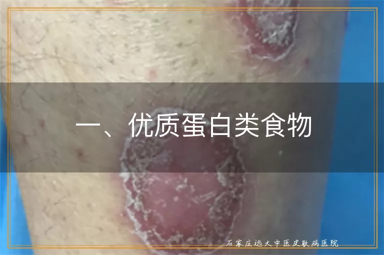 一、优质蛋白类食物