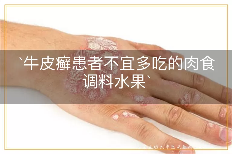牛皮癣患者不宜多吃的肉食调料水果