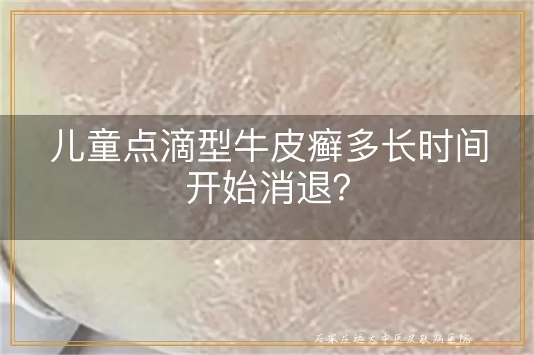 儿童点滴型牛皮癣多长时间开始消退？