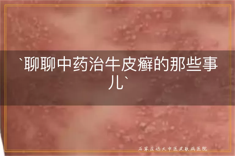 聊聊中药治牛皮癣的那些事儿