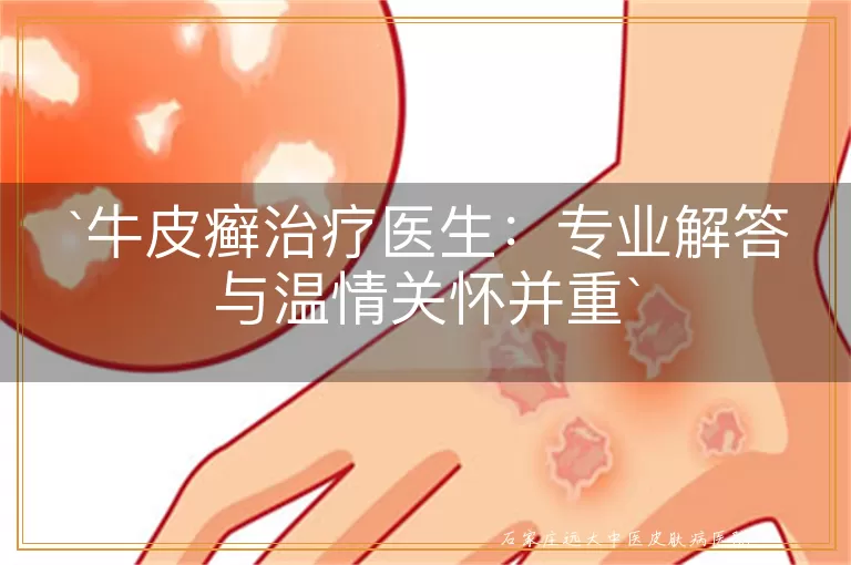 牛皮癣治疗医生：专业解答与温情关怀并重