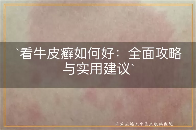 看牛皮癣如何好：全面攻略与实用建议