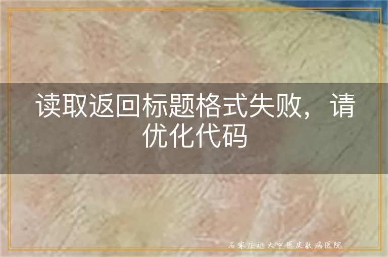 读取返回标题格式失败，请优化代码