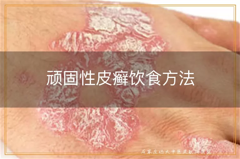 顽固性皮癣饮食方法