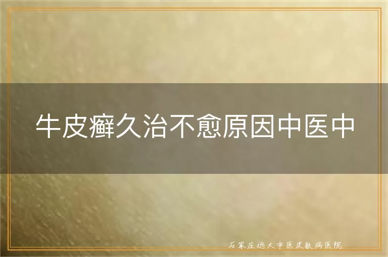 牛皮癣久治不愈原因中医中