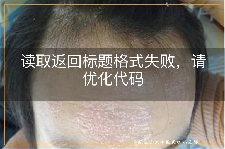 读取返回标题格式失败,请优化代码