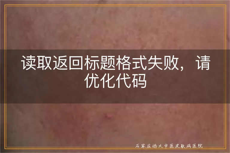 读取返回标题格式失败，请优化代码