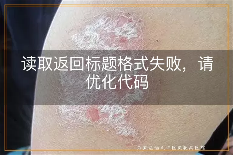 读取返回标题格式失败，请优化代码